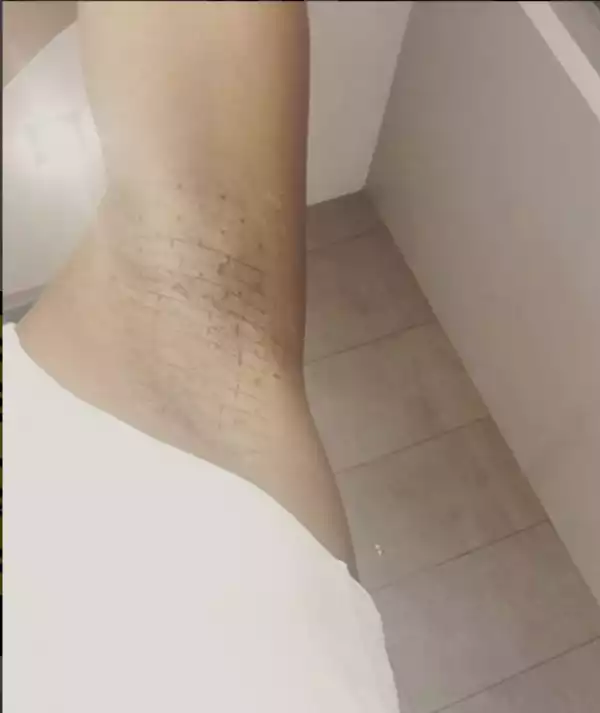 Maheeda Undergoes N500,000 Treatment To Curb Armpit Sweating (Watch Video)